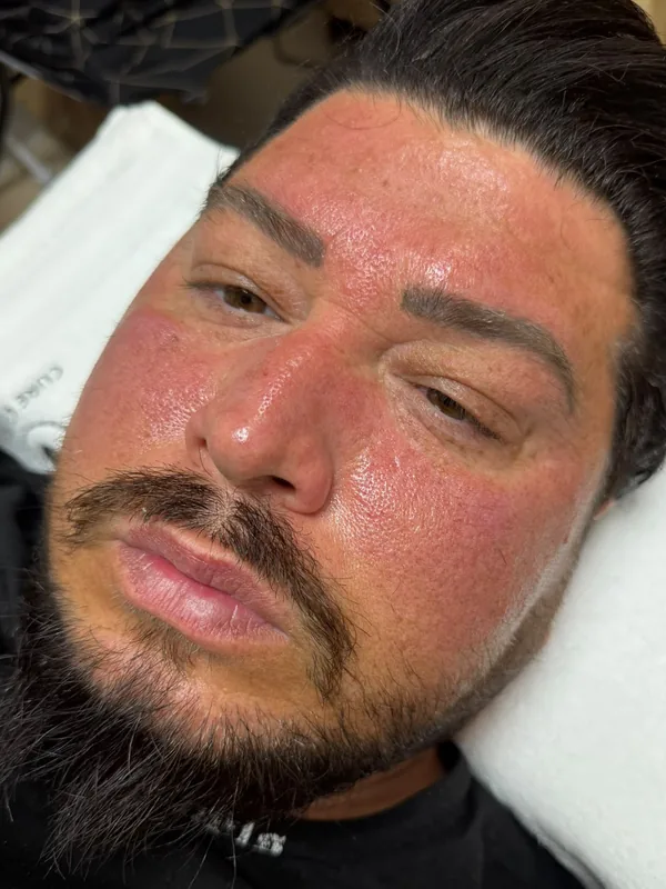 Gesicht eines Kunden mit gut durchbluteter, glatter Haut nach dem Aqua Facial