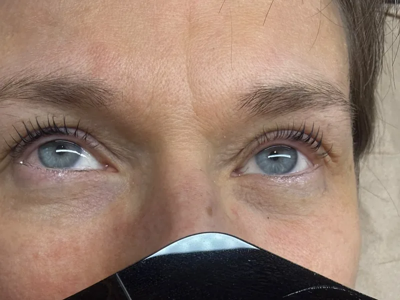 Dieselbe Augenpartie mit gelifteten Wimpern nach der Behandlung