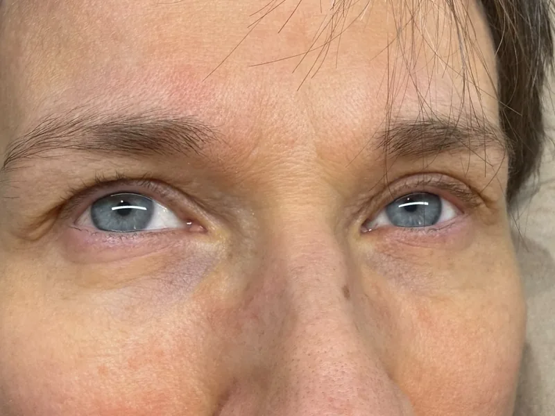 Augenpartie mit geraden Naturwimpern vor der Behandlung