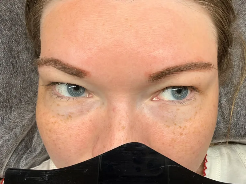 Augenpartie vor dem Wimpernlifting