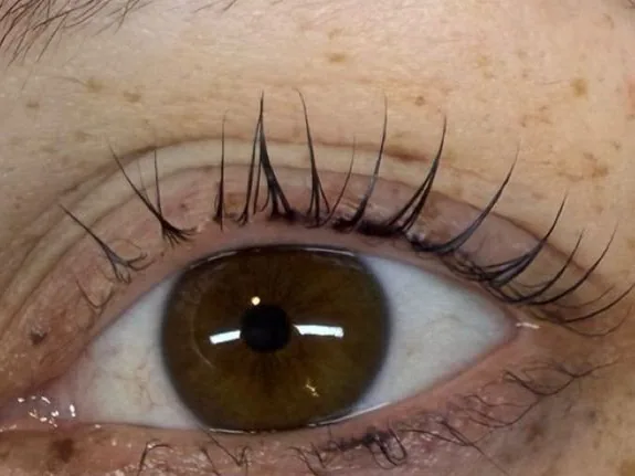 Dasselbe Auge mit geschwungenen, gefärbten Wimpern nach dem Wimpernlifting