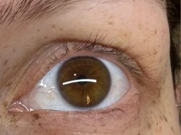 Auge mit kurzen, geraden Naturwimpern vor dem Wimpernlifting