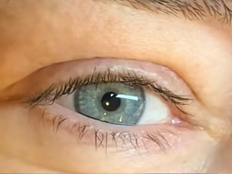 Blaues Auge mit hellen, geraden Wimpern vor dem Wimpernlifting